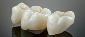 metal free ceramic dental crowns 2022 12 20 16 37 08 utc