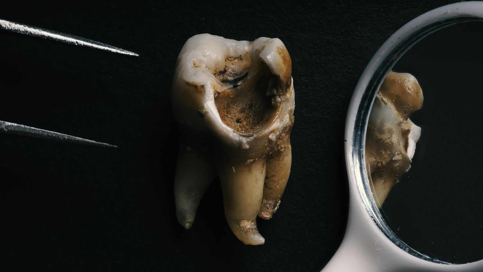 Read more about the article 做假牙相關大小事一次看，醫師解答常見疑問：沒有牙根可以做假牙嗎？